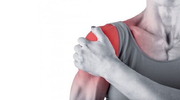 Rách cơ chóp xoay gây đau khi cử động khớp vai
