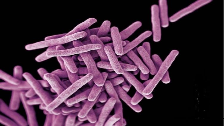 Vi khuẩn Mycobacterium Tuberculosis