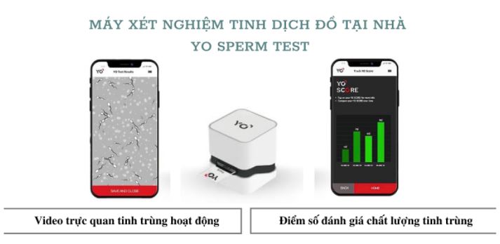 Theo dõi video tinh trùng hoạt động và điểm số đánh giá chất lượng tinh trùng với Yo Sperm Test