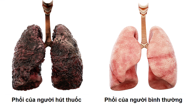 Có nhiều chất phụ gia nguy cơ gây phá huỷ phổi