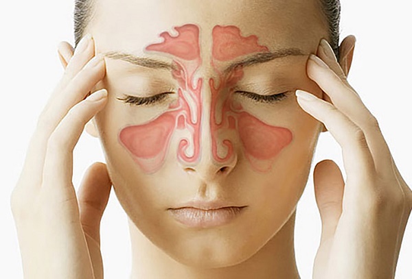 Thuốc xoang Nhất Nhất giúp giảm nhanh chóng các triệu chứng khó chịu như nghẹt mũi, chảy nước mũi, đau nhức đầu...