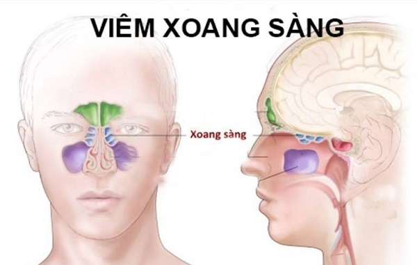 Cấu tạo giải phẫu và vị trí của xoang sàng trên vùng đầu mặt